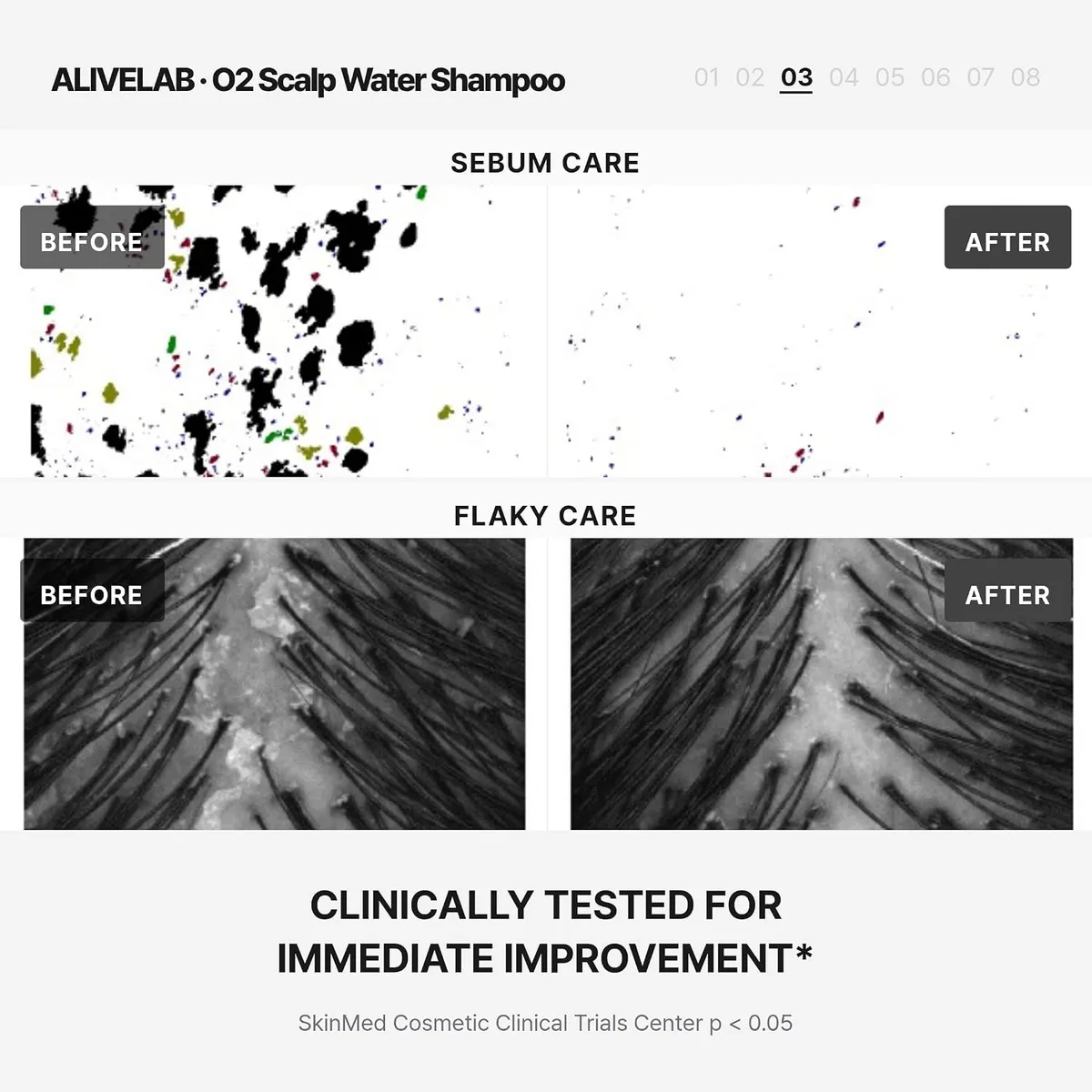 ALIVE:LAB - O2 Scalp Water Shampoo - Shampoing – photo 5