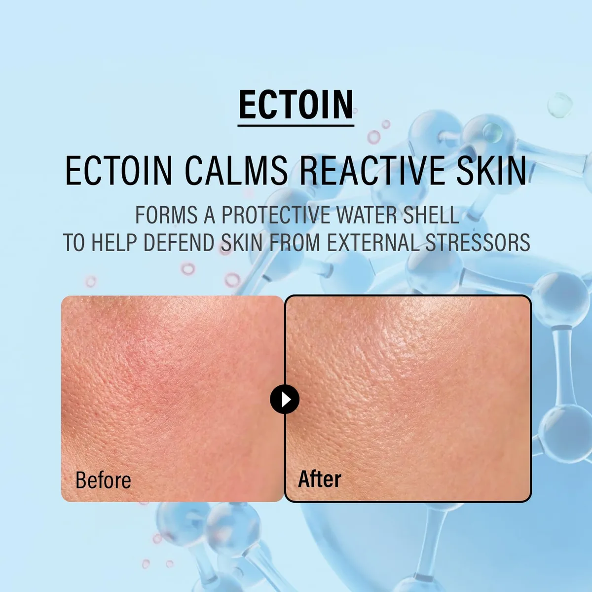 epii - Double Up Cream Ectoin & Panthenol - Crème hydratante apaisante – photo 3