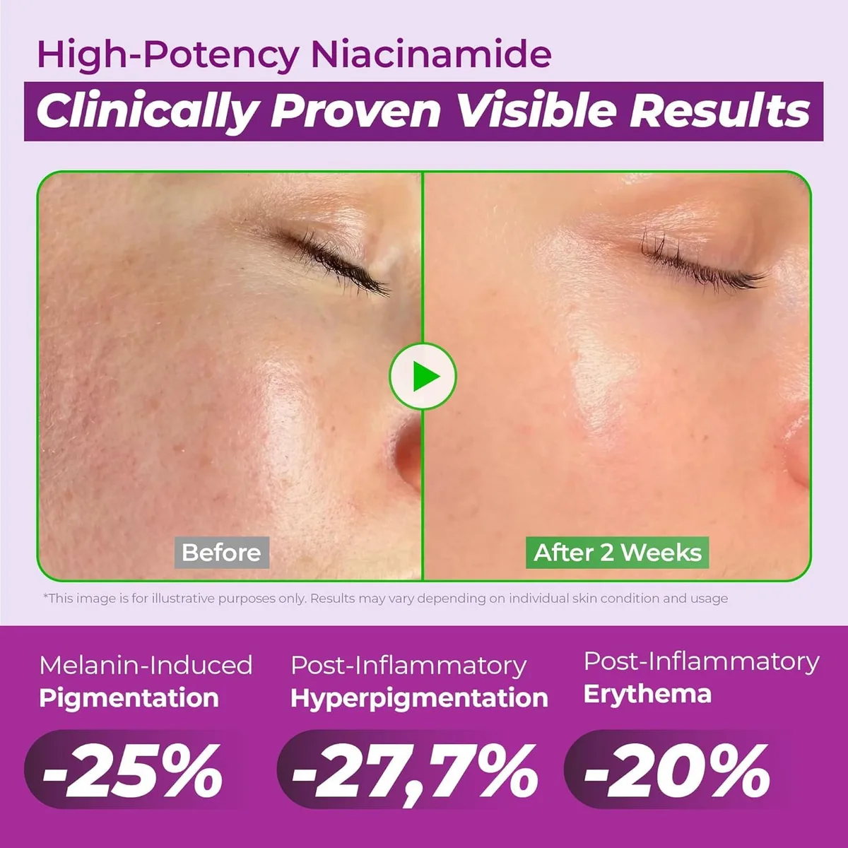 JUMISO - Niacinamide 20 Serum - Sérum éclaircissant – صورة 5