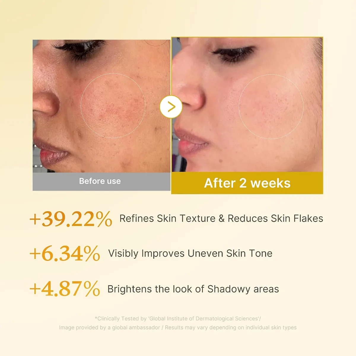 medicube - Kojic Acid Turmeric Resurfacing Toner - Lotion tonique resurfaçante à l'acide kojique et au curcuma – photo 4