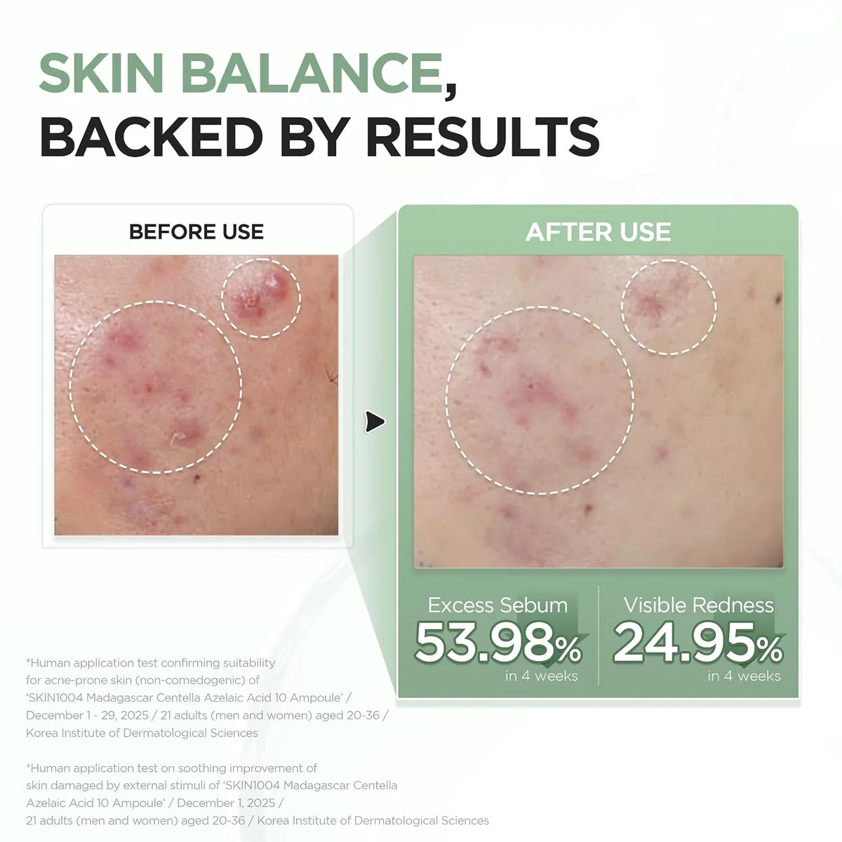 SKIN1004 - Lab in Nature Madagascar Centella Azelaic Acid 10 Ampoule - Sérum anti-imperfections – photo 3