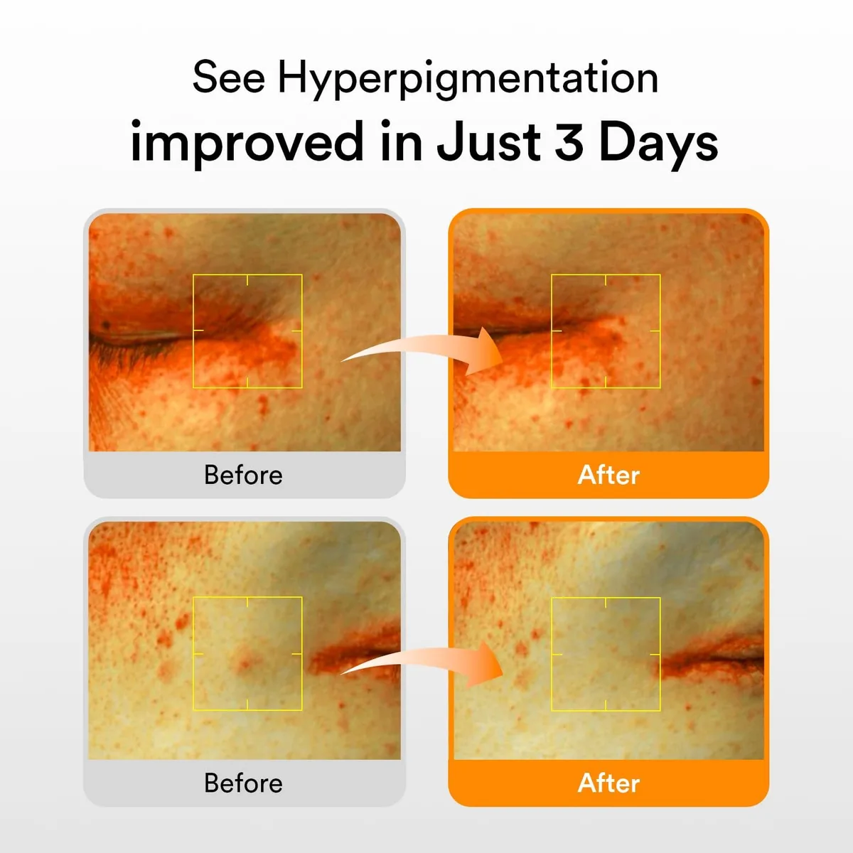 Abib Glutathiosome dark spot serum – صورة 5