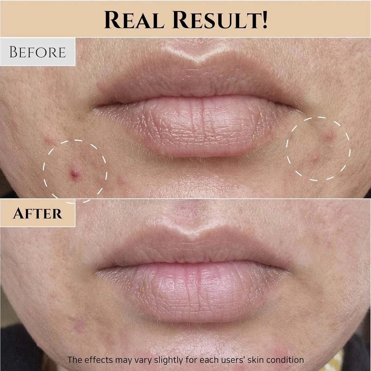 Beauty of Joseon Glow Replenishing Rice Facial Sebum Toner – صورة 5