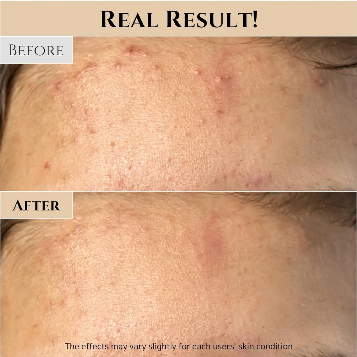 Beauty of Joseon Ground Rice and Honey Glow Mask Pore – صورة 2