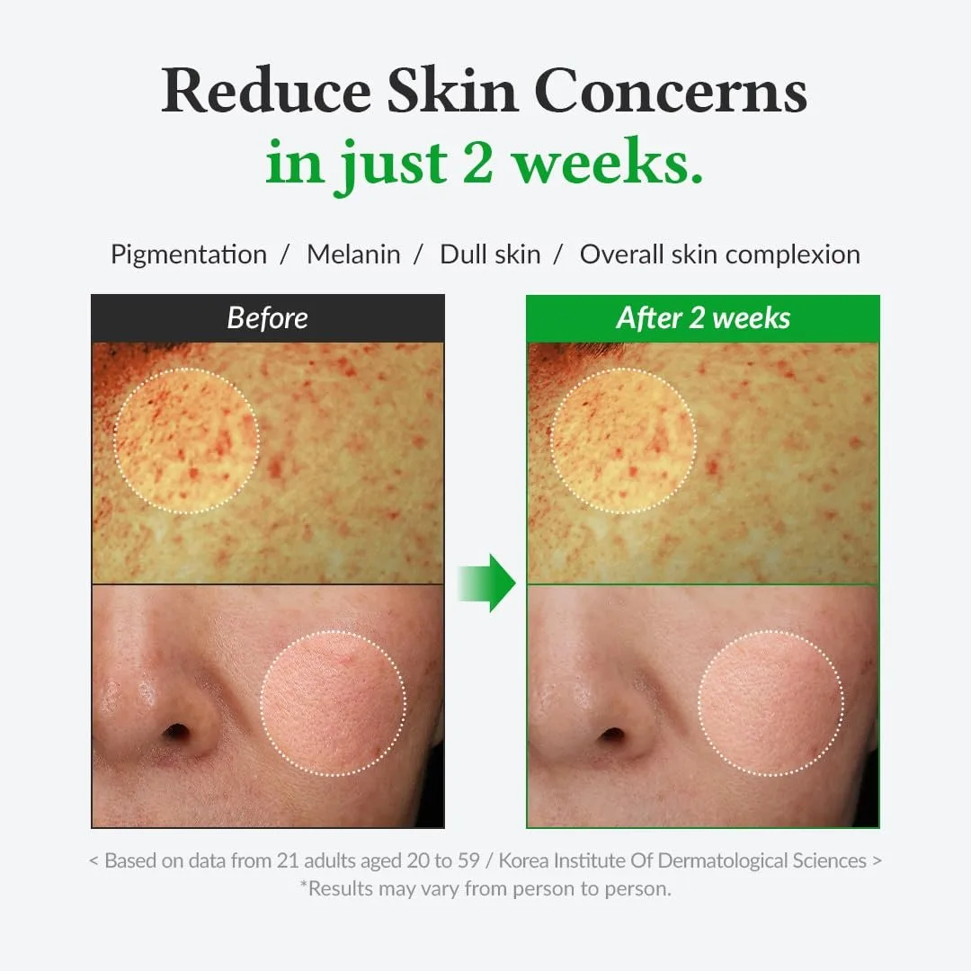 Dr.Althea Gentle Vitamin C Serum – صورة 3