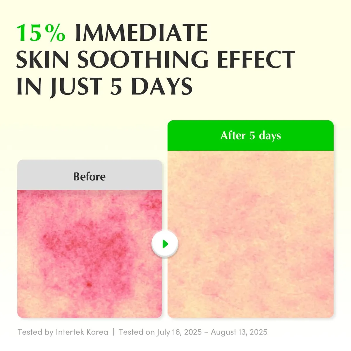 EQQUALBERRY - Aloe PDRN Calming Serum - Sérum apaisant à l'aloe vera et au PDRN – صورة 4
