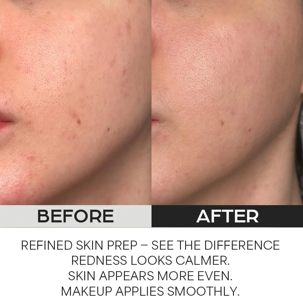 House of Hur - Clearing Skin Prep Essence Pad - Disques exfoliants – صورة 2
