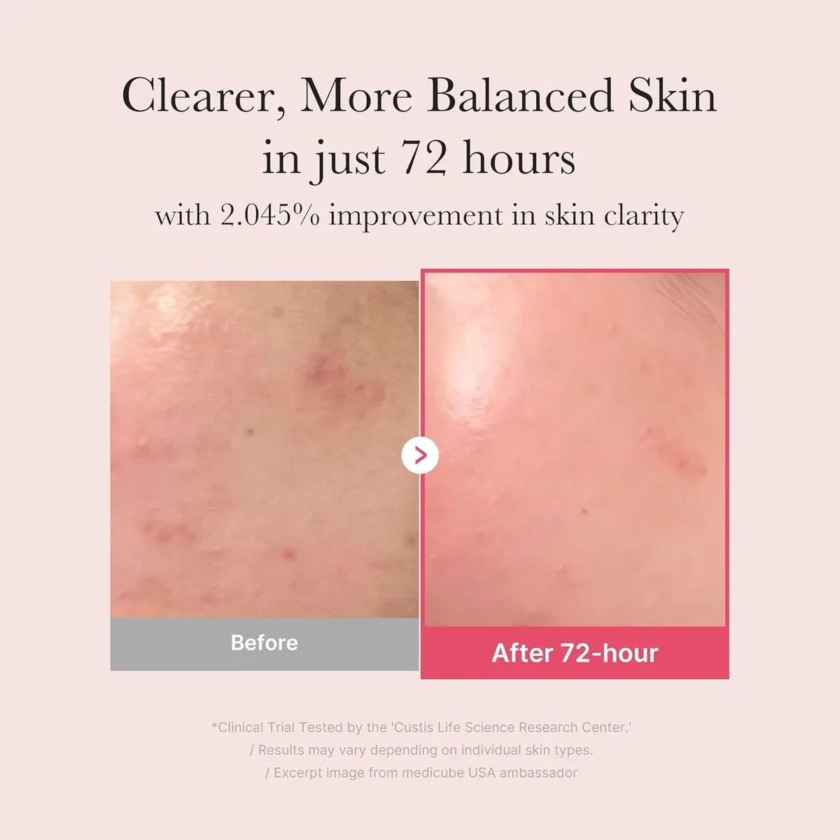 Medicube Kojic Acid Turmeric Overnight Wrapping Peel Off Mask – صورة 4