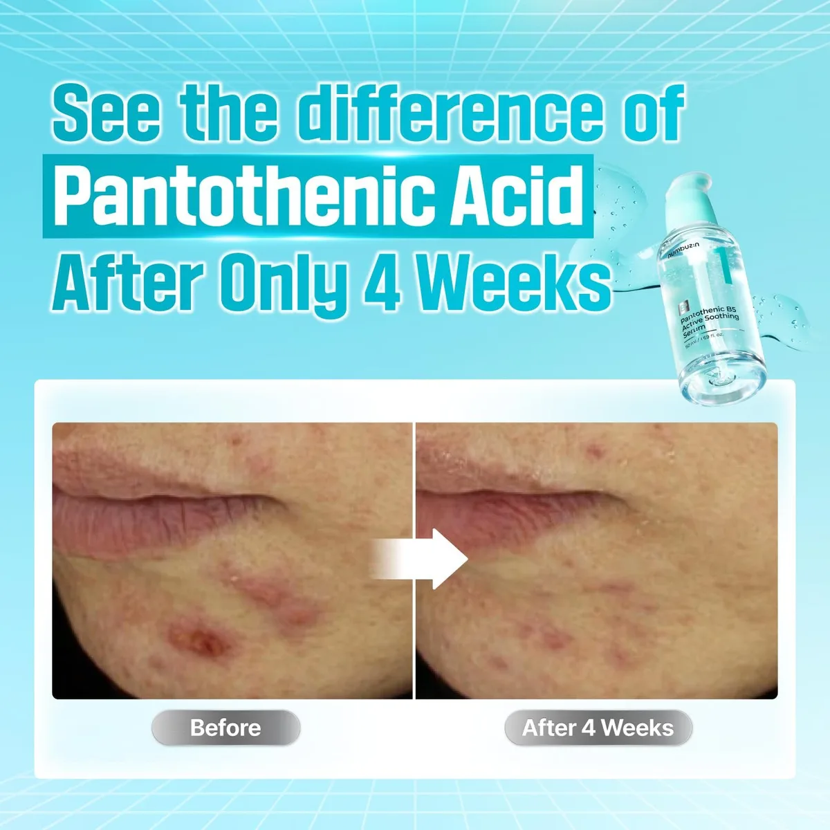 numbuzin No.1 Pantothenic B5 Active Soothing Serum – صورة 3