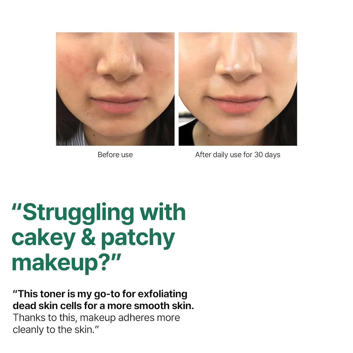 SOME BY MI AHA BHA PHA 30 Days Miracle Toner – صورة 5