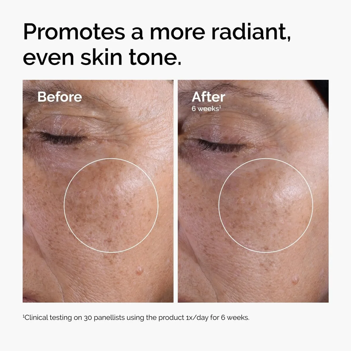 The Ordinary Glycolic Acid 7% Exfoliating Toner – صورة 4