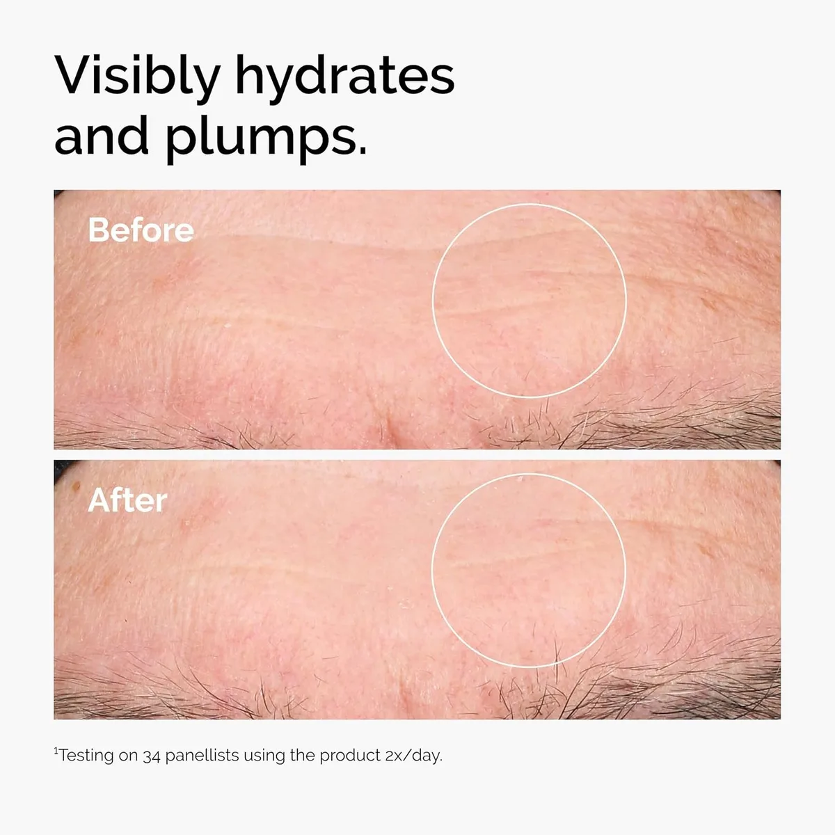 The Ordinary Hyaluronic Acid 2% + B5 – صورة 4