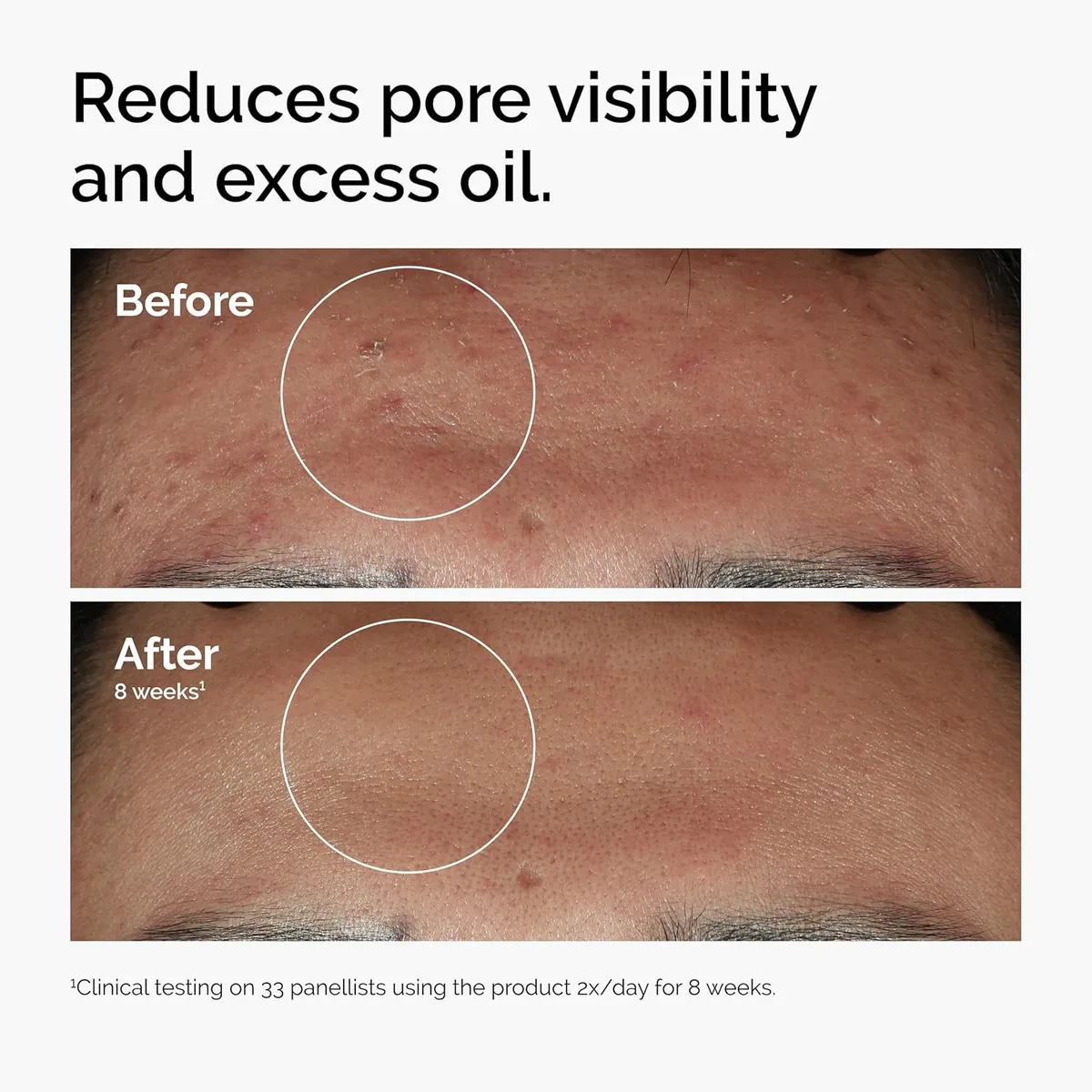 The Ordinary Niacinamide 10% + Zinc 1% – صورة 4