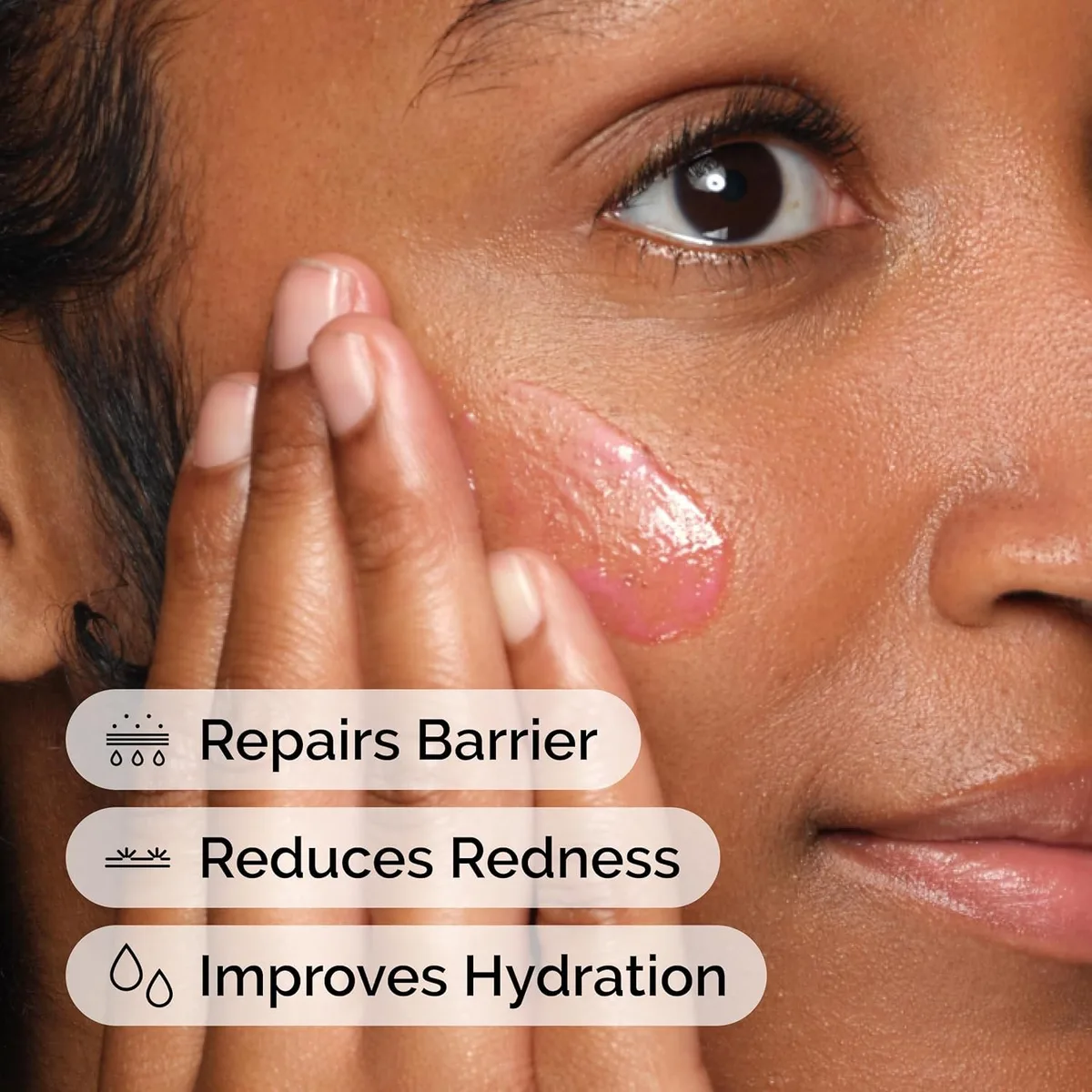 The Ordinary Soothing & Barrier Support Serum – صورة 4