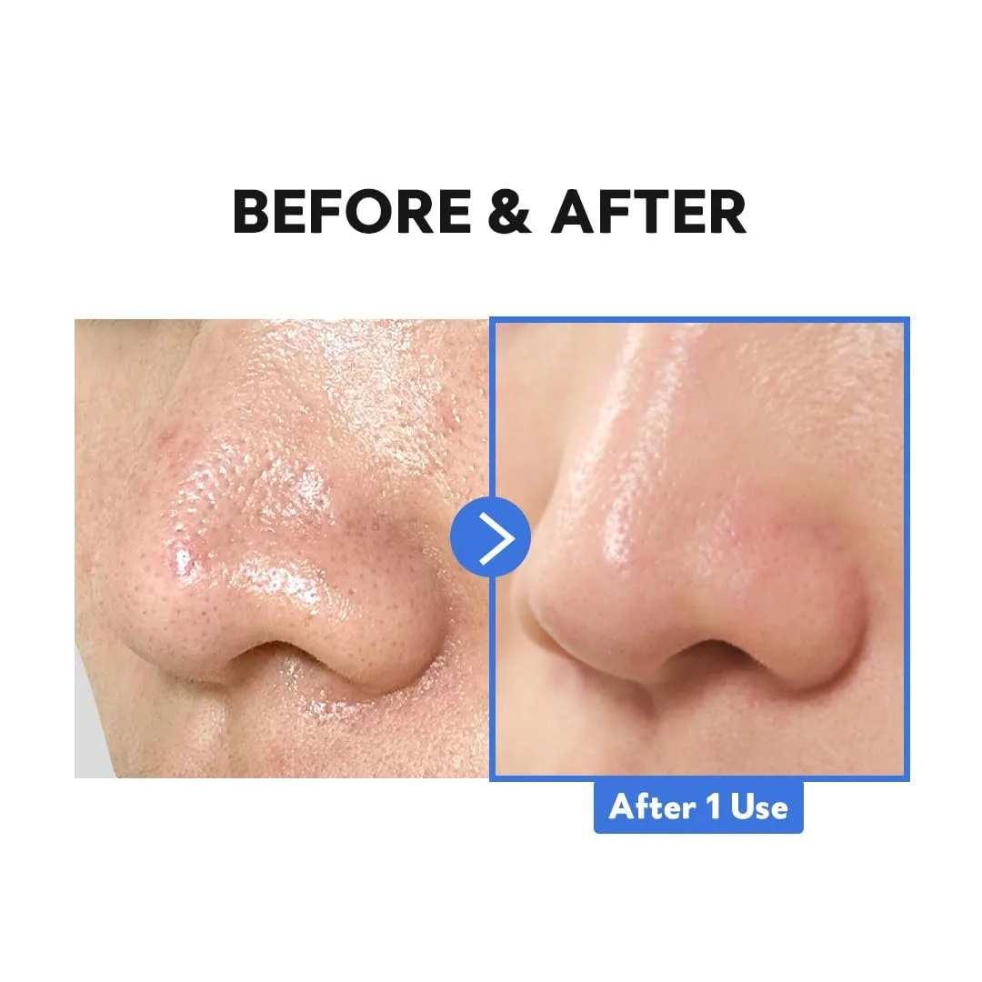 TIRTIR Hydro Boost Enzyme Cleansing Balm – صورة 4